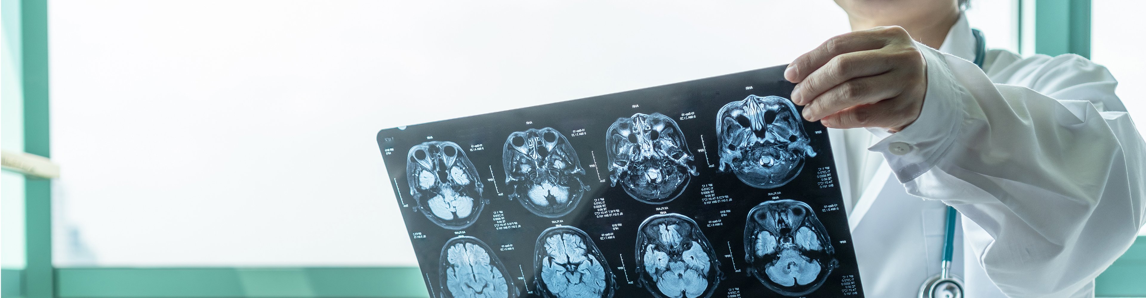 Provider analyzing MRI scan of a brain.